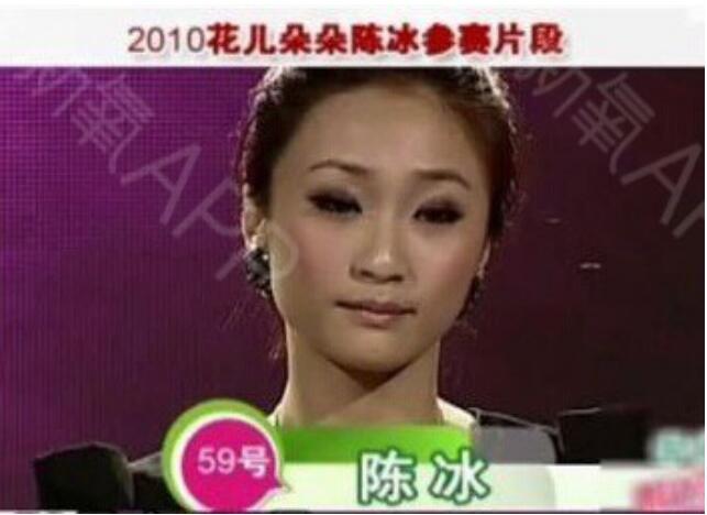 陳冰整容前后照片對比照，陳冰現在的現狀如何